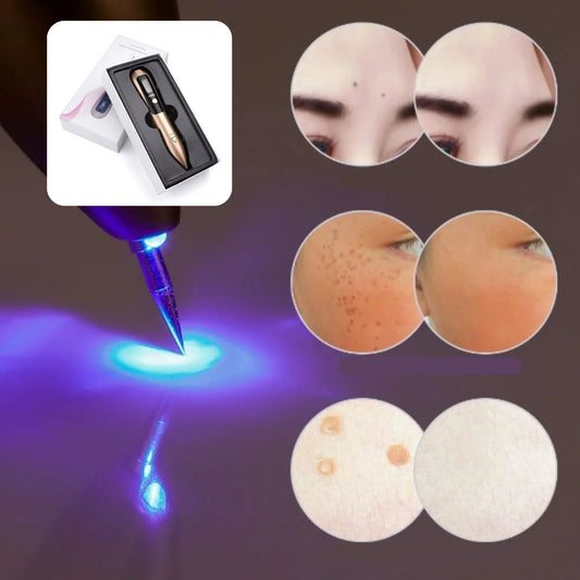 Pluma laser - elimina imperfecciones de la piel al instante😱